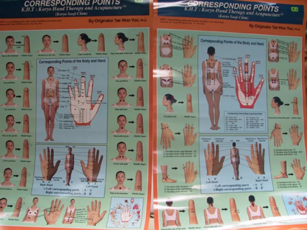 Koryo   Hand Acupuncture Corresponding Chart