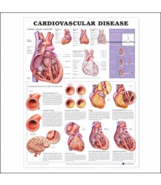 Cardiovascular Disease Anatomical Chart