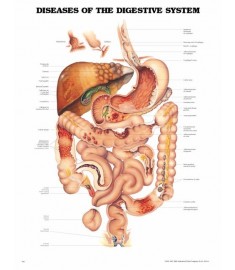 Diseases of the Digestive System Anatomical Chart