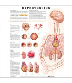 Hypertension Anatomical Chart